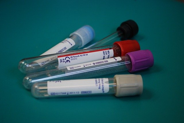 血液検査の容器